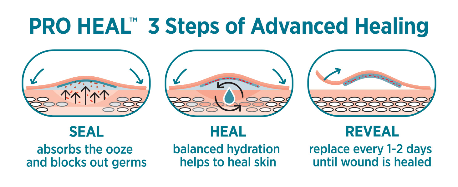 Advanced hydrocolloid gel pads support better healing by absorbing ooze &amp; blocking germs