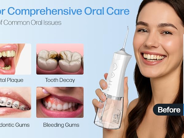 Water Dental Flosser Cordless for Teeth