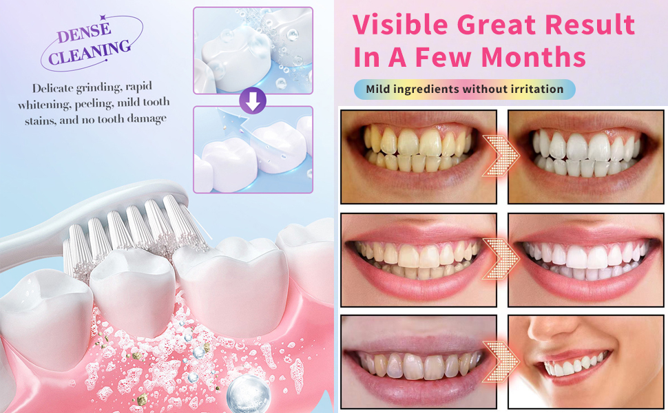 Niacinamide Whitening Toothpaste