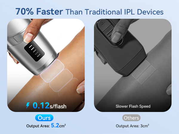 Laser hair removal for women