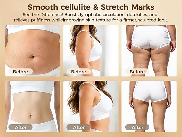 lymphatic drainage tool