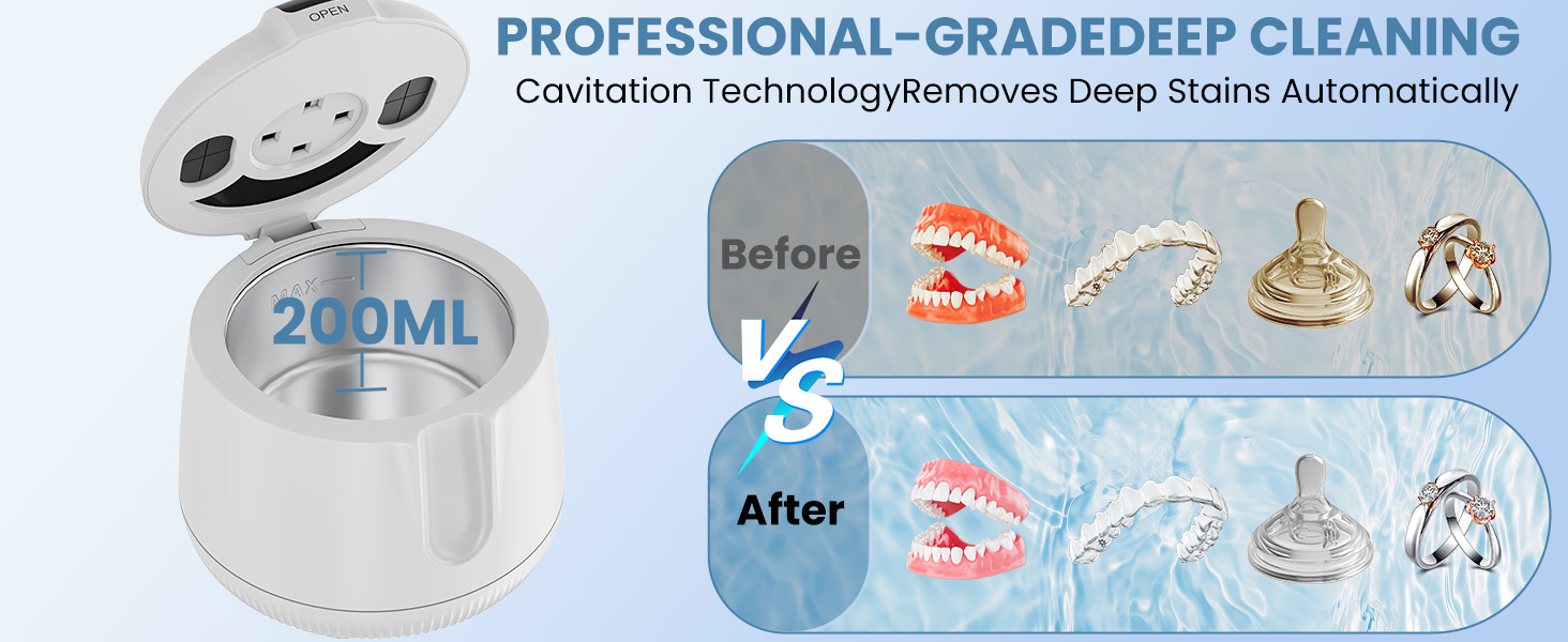 ultrasonic retainer cleaner