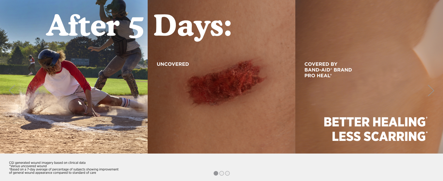 Better Healing and Less Scarring Compared to Uncovered Wound