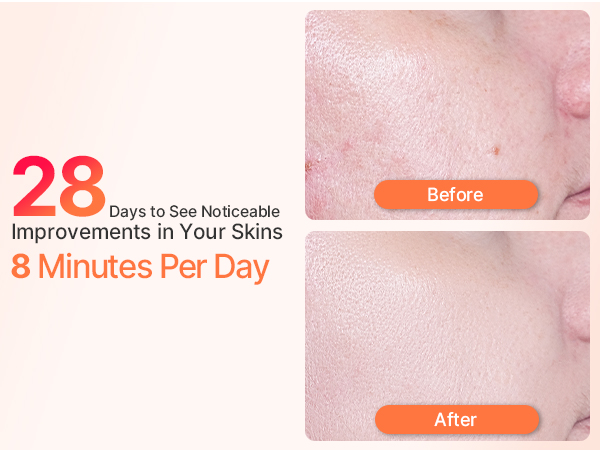 Hot &amp; Cold Facial Massager