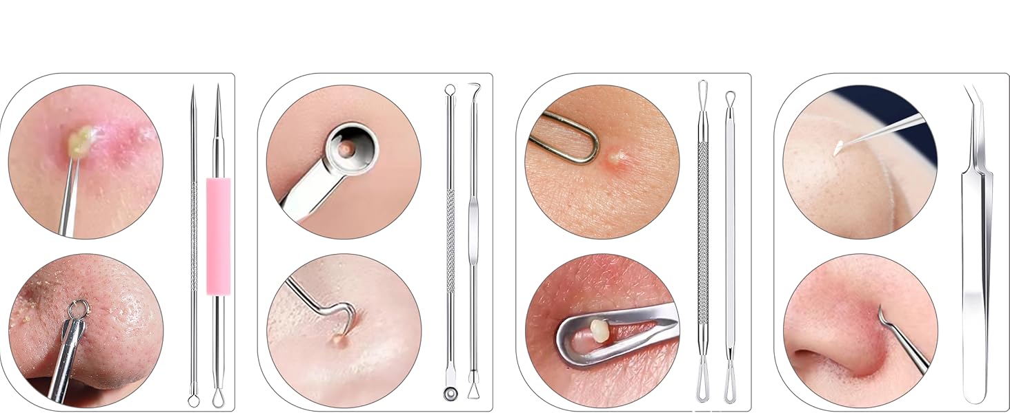 Acne Pimple Extractor Tool