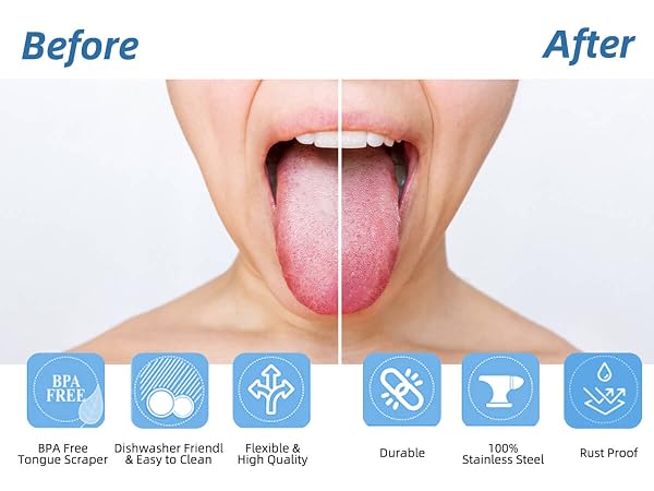 Aussumy 6 Pack Tongue Cleaners