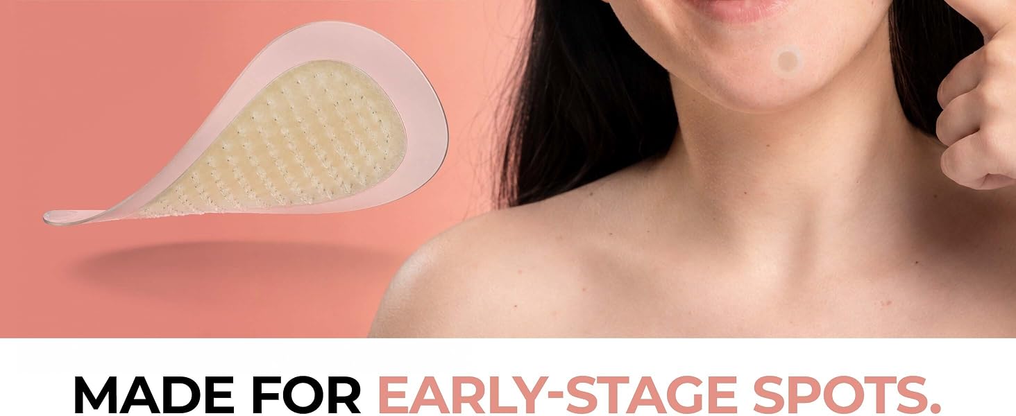 Made for early stage spots.