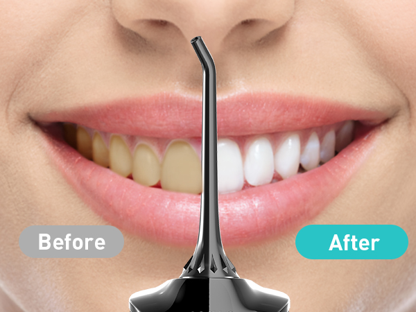 water dental flosser pick teeth cordlss portable Hilo dental con agua, recoge los dientes