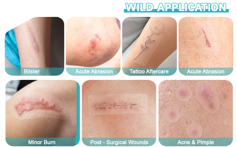 wild application for blister scute abrasion tattoo aftercare scute abrasion minor burn
