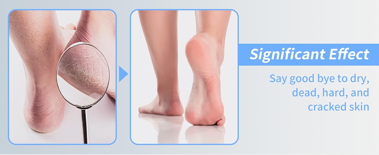 foot file