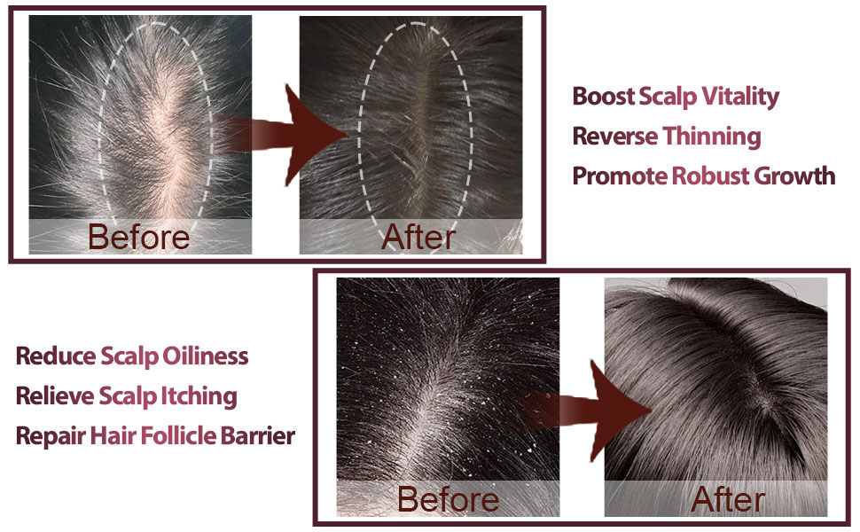 Electric Scalp Massager