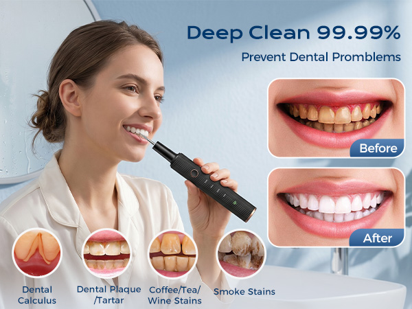 dental tools