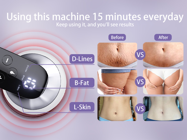 Body Sculpting Machine