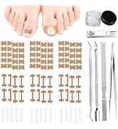 Ingrown Toenail Corrector Set with Correction Strips, Professional Ingrown Toenail Removal Kit, P...