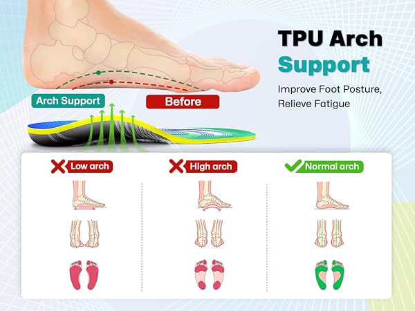 metatarsalgia insoles