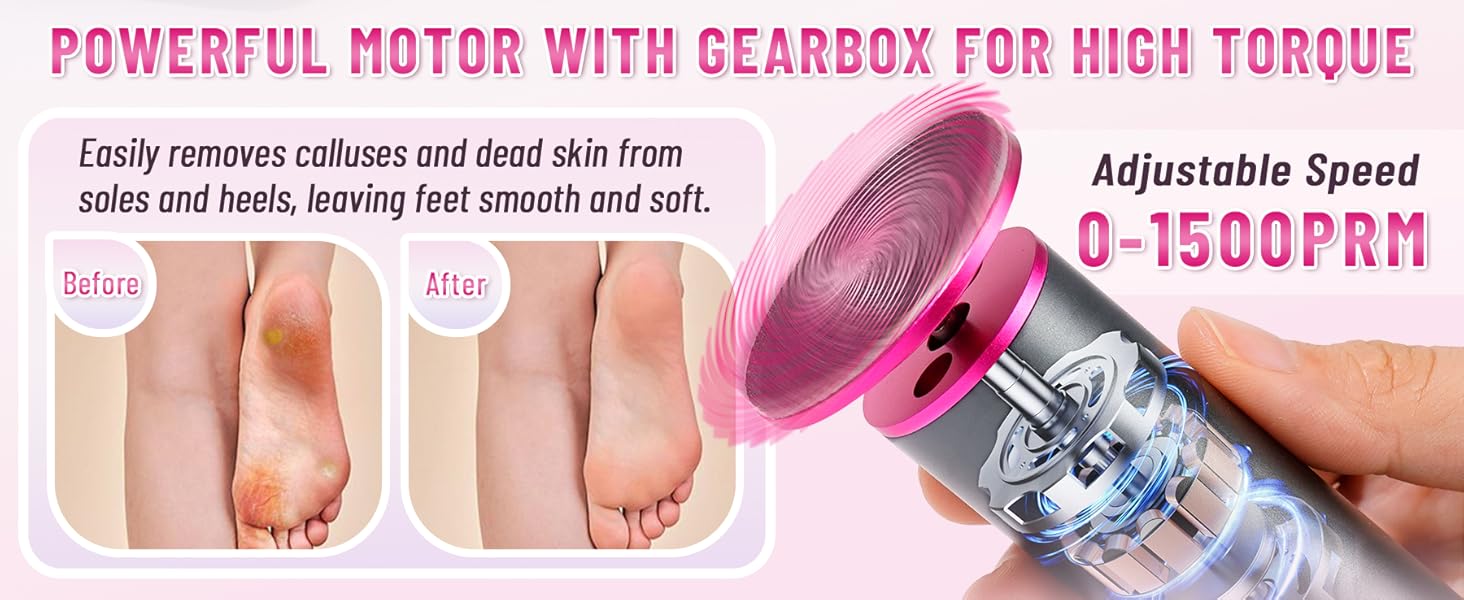 electric foot callus remover