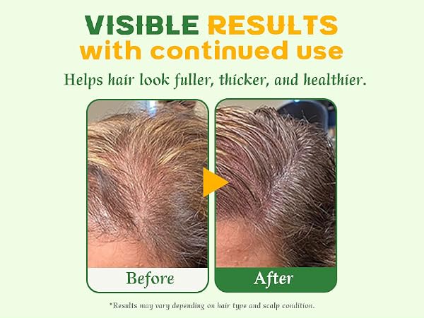 rosemary shampoo bar hair growth Oily Sensitive Itchy Thinning Dandruff Prone Scalp travel size