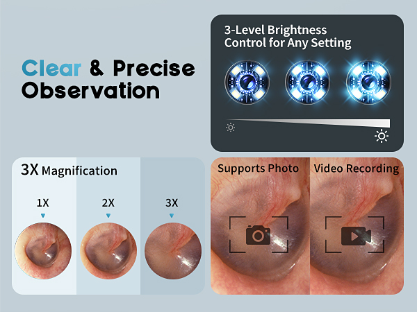 otoscope