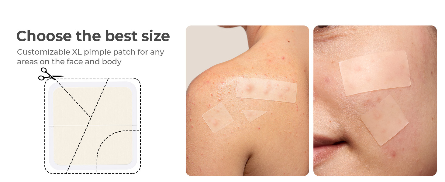 large pimple patches
