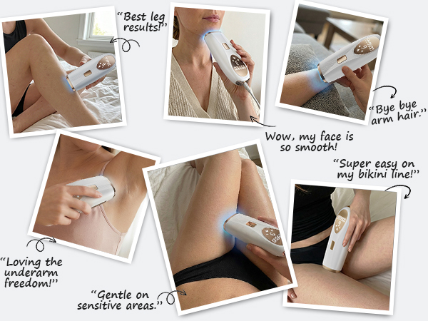 laser hair removal device