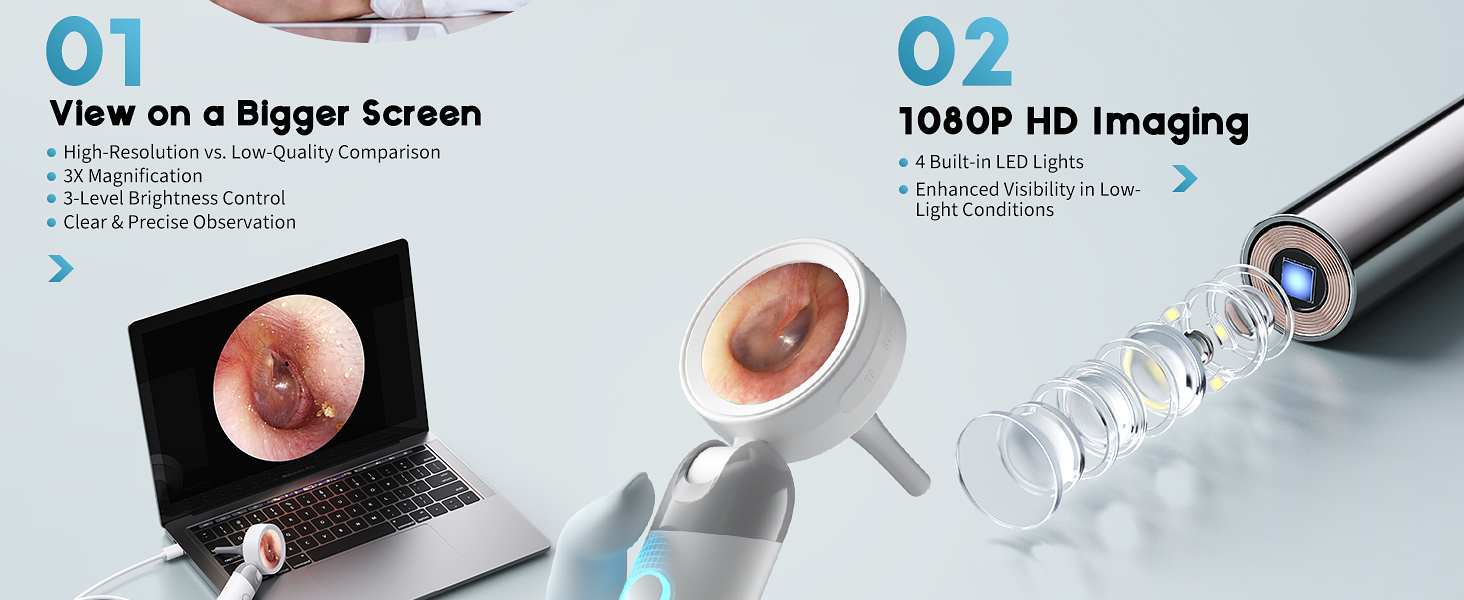 Otoscope