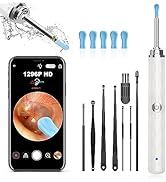 Ear Wax Removal, Ear Cleaner with Camera and Light, Ear Wax Removal Kit with 1296P Otoscope, Ear ...