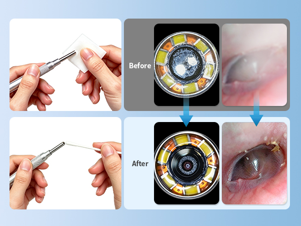 otoscope, ear wax removal tool, ear camera