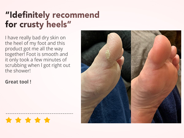 Foot Files 