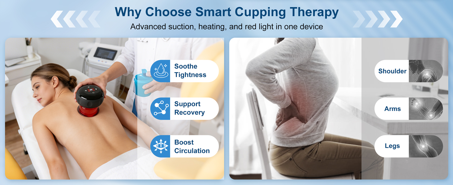 cupping therapy set