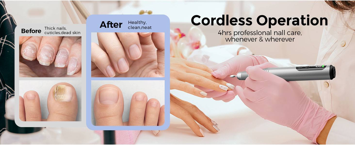 Electric Nail File