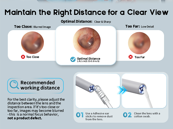 otoscope