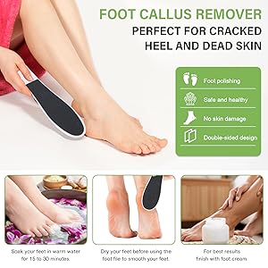 foot file for dead skin