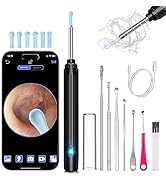 Ear Wax Removal, Ear Cleaner, Ear Wax Removal Tool with 1269P, Ear Camera Otoscope with Light, Ea...