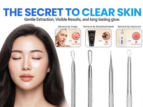 stainless steel pimple extractor