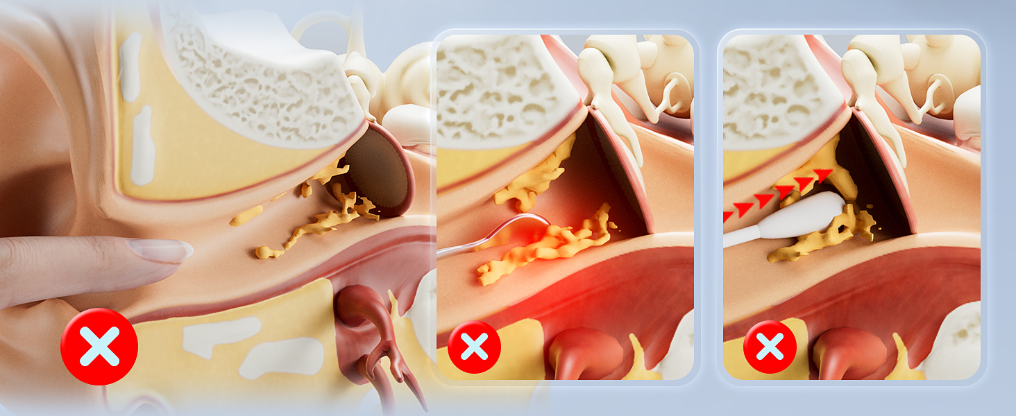 Ear Wax Removal