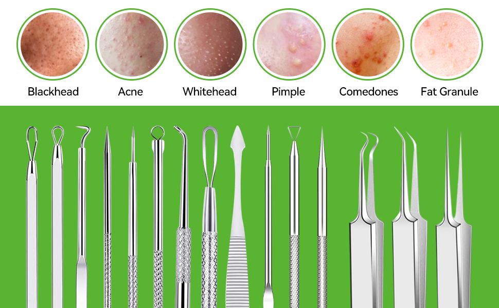 Blackhead black head acne whitehead white head pimple comedone fat granule