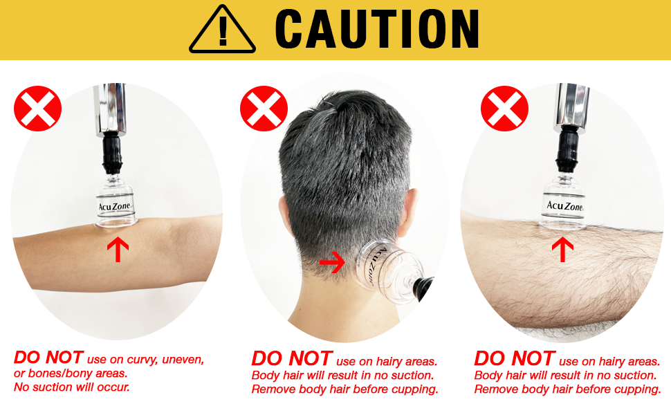 Caution Info for Cupping Set