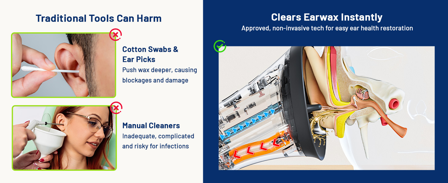 KAUGIC vs Traditional Kit