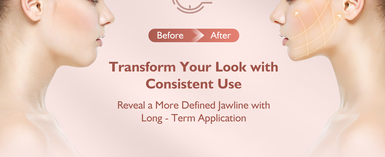 double chin reducer