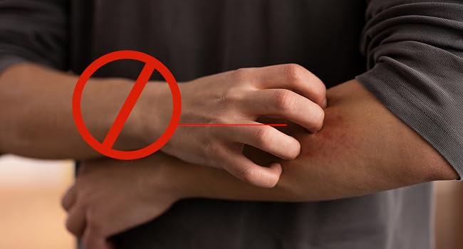 big bandaids for adults skin irritation