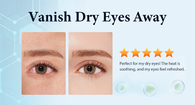 eye compress moist heat