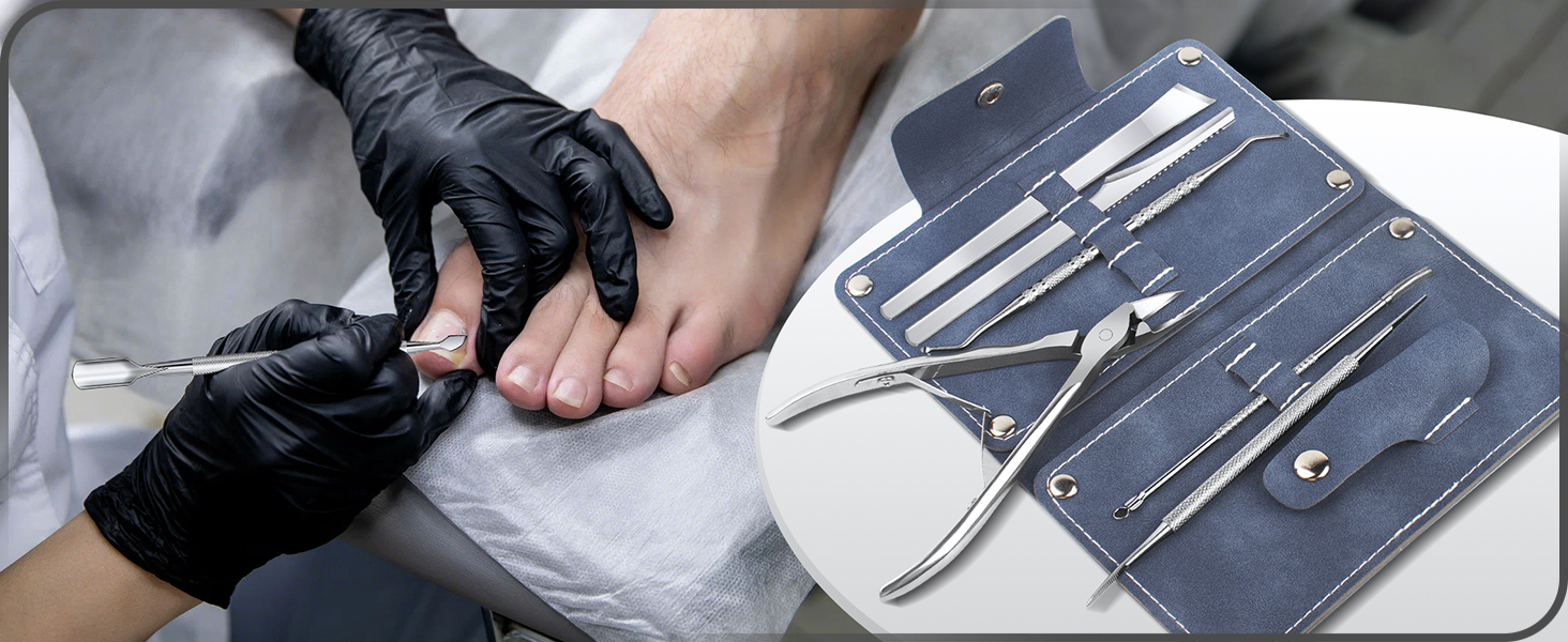 Ingrown Toenail Treatment