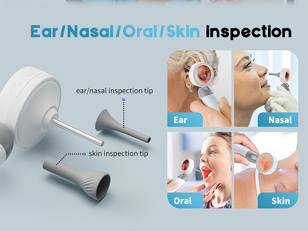 Otoscope