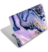 ArtSo Laptop Skin Sticker Decal, 12" 13" 13.3" 14" 15" 15.4" 15.6 inch Laptop Universal Netbook P...