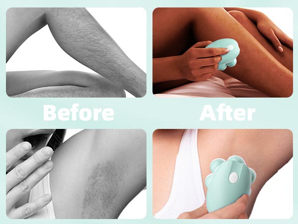 leg shaver for women