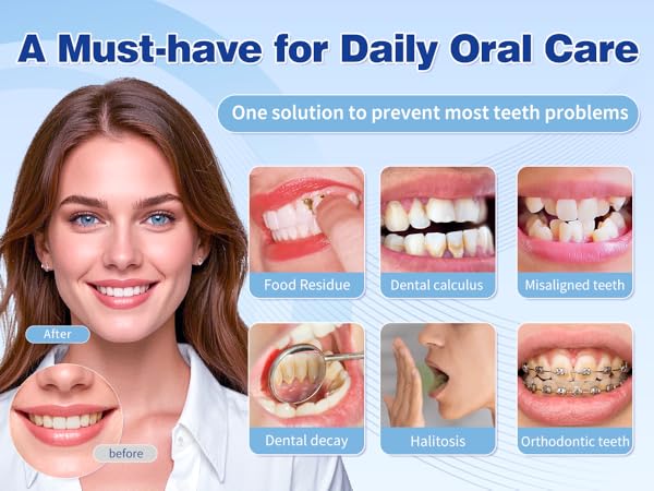 Tovendor electric flosser with 5 Multifunction Nozzles will help you keep oral and teeth health