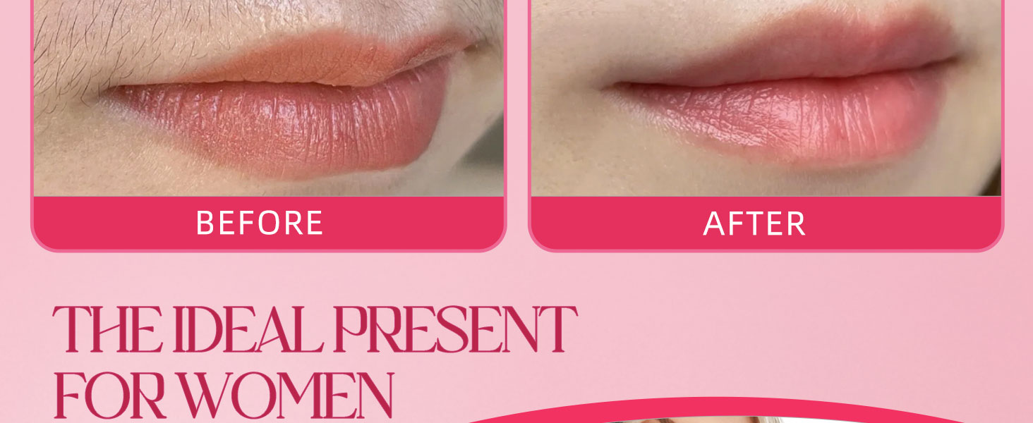 Facial Hair Removal for Women