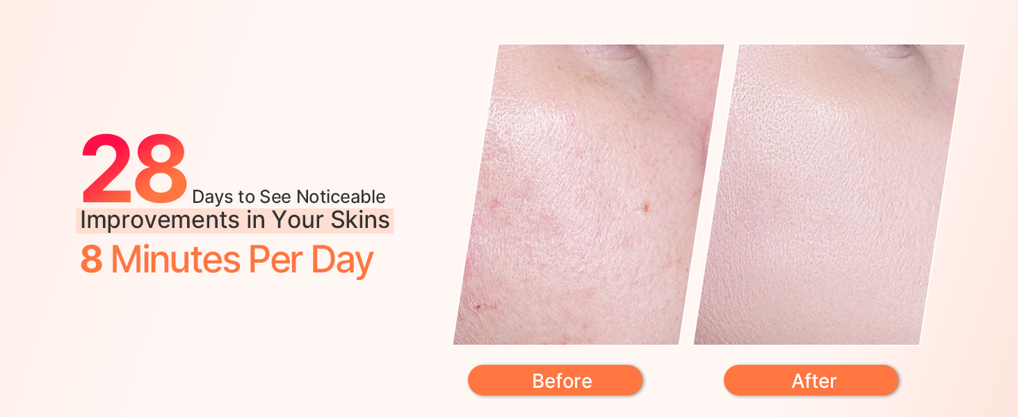 Hot &amp;amp; Cold Facial Massager