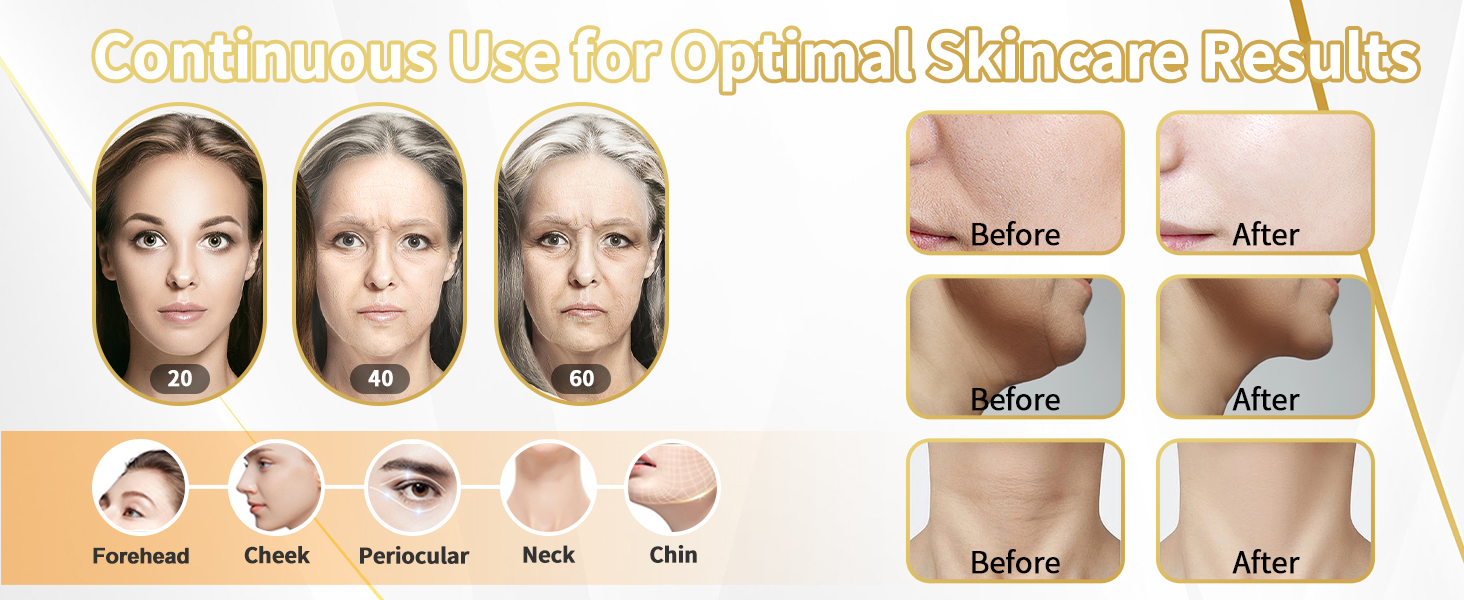 Face Light Therapy Device