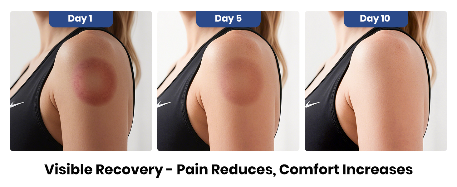 electric cupping device